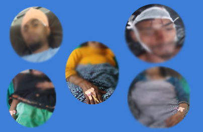 विद्यालयको बाउन्ड्रीभित्र बाटो विवाद, पर्सामा झडप—दुई पुरुष र तीन महिला घाइते